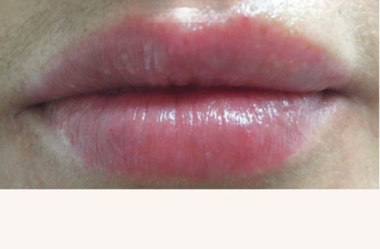 After