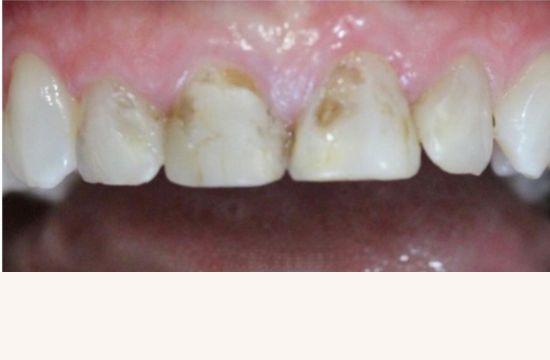 Before