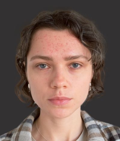 Before (Face)